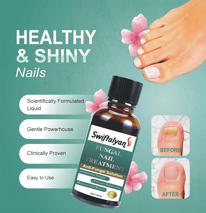 Swiftalyan Fungal Nail Treatment Oil 30ml + Nail File – Natural Anti-Fungal Solution for Toenails & Fingernails